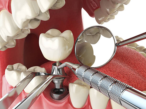 Best Emergency Treatment for Oral Infections in Belvidere, NJ