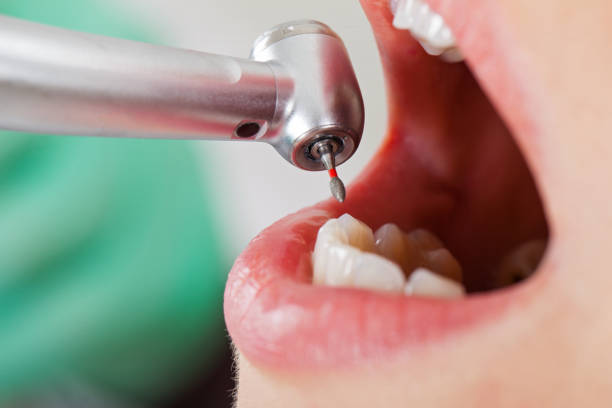 Best Emergency Treatment for Oral Infections in Belvidere, NJ